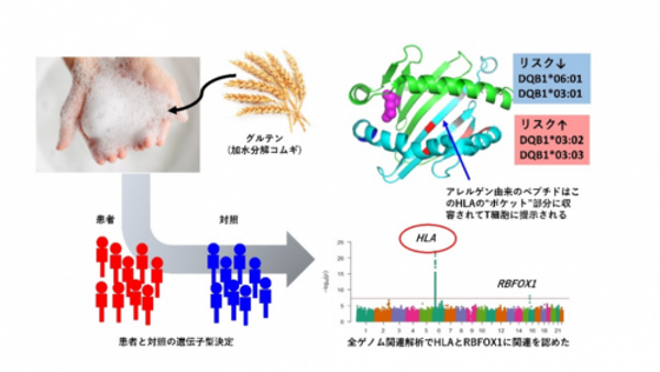 筑波大・藤田医大、経皮感作小麦アレルギーの関与遺伝子を特定